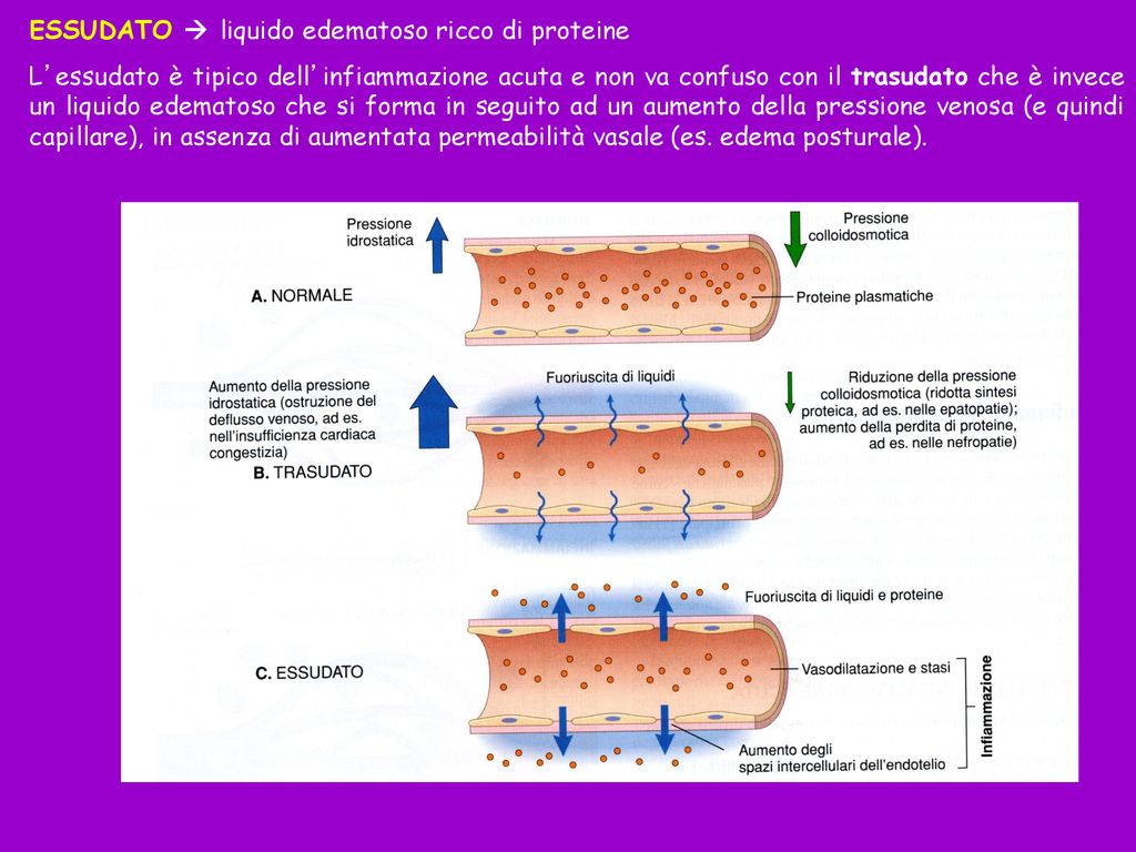 L Infiammazione Acuta Ppt Scaricare